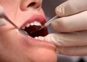 dentistas en carrasco uruguay