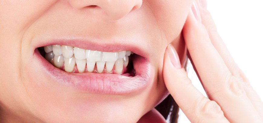 Tienes bruxismo? 3 consejos para evitarlo - Nart Clínica Dental