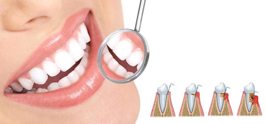 periodoncia y regeneracion dental