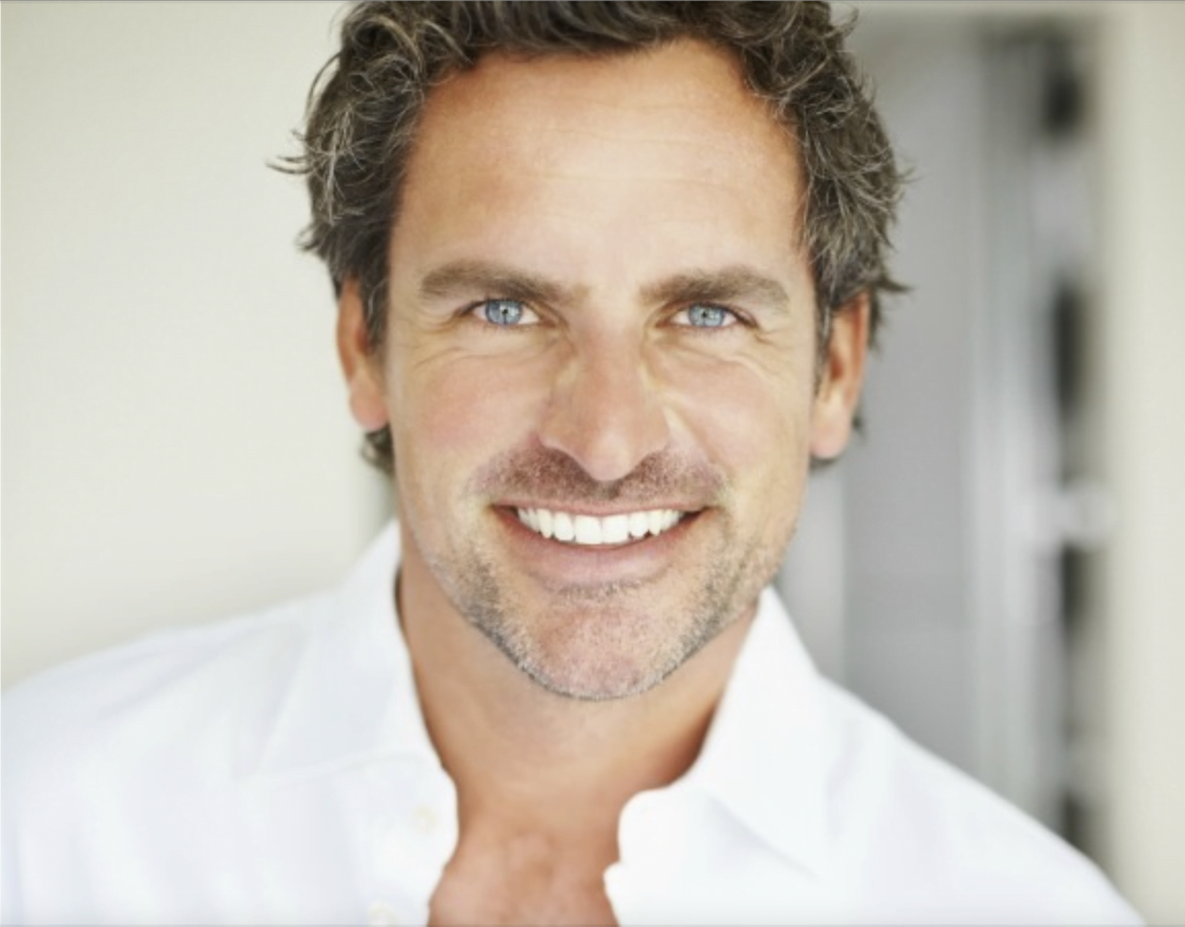 carillas-dentales-biosmile