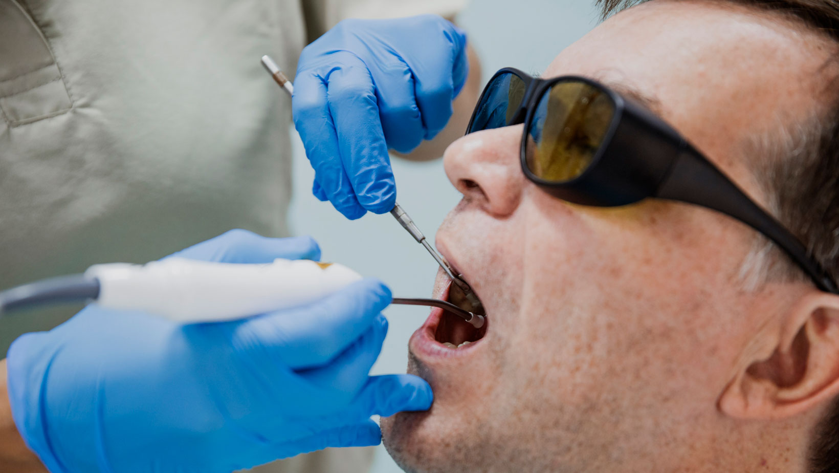 Tratamiento LANAP con láser en periodoncia para tratar la periodontitis sin cirugía